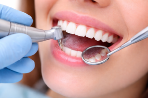 ABDC image Services Dental Cleaning