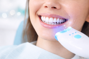 ABDC image Services Teeth Whitening