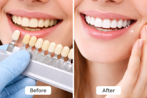 ABDC image Services smile makeover